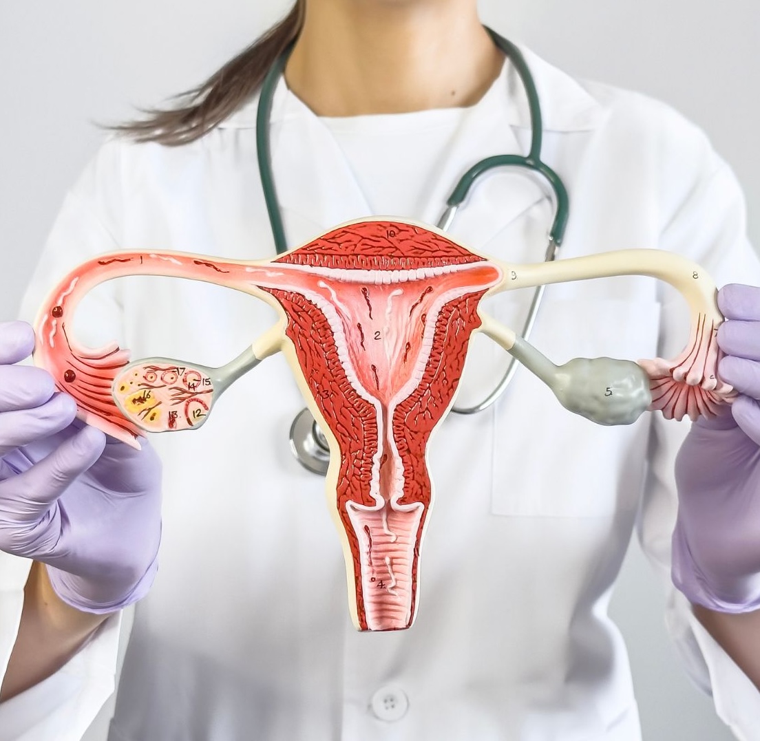 Physician holding a model of a uterus